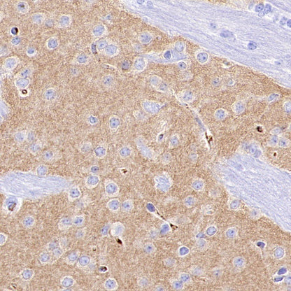 GABRD Recombinant Rabbit mAb (S-1584-162)