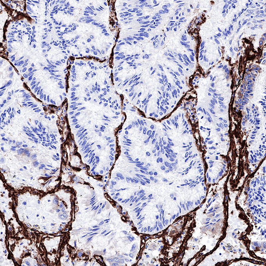Caveolin-1 Recombinant Rabbit mAb (SDT-065-20)