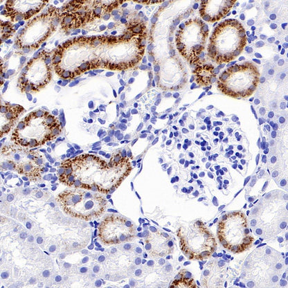 LAMP1 Recombinant Rabbit mAb (S-952-18)