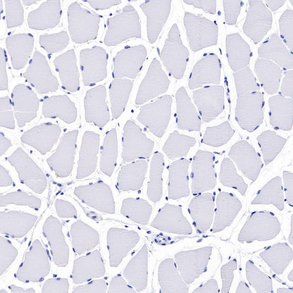 C1q Recombinant Rat mAb (S-R189)