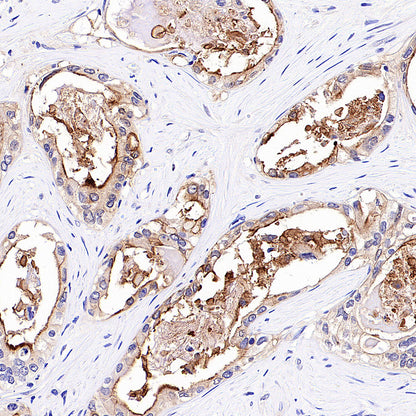 SLC6A14 Recombinant Rabbit mAb (S-5961)