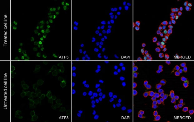ATF3 Recombinant Rabbit mAb (SDT-4100)