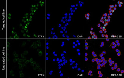 ATF3 Recombinant Rabbit mAb (SDT-4100)