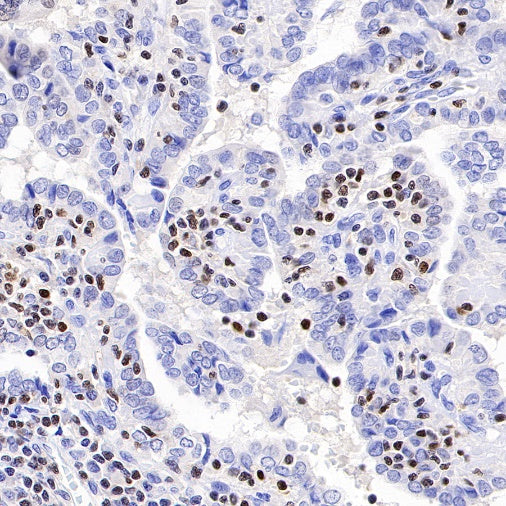 T-bet/TBX21 Recombinant Rabbit mAb (S-583-54)