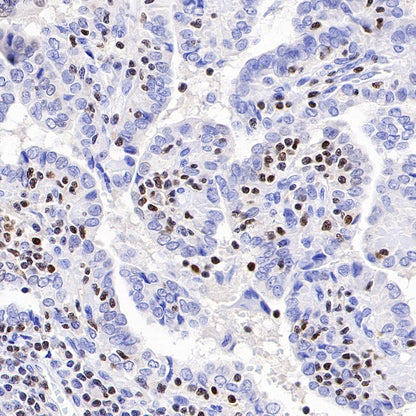 T-bet/TBX21 Recombinant Rabbit mAb (S-583-54)