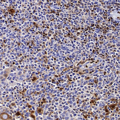 ALOX5 Recombinant Rabbit mAb (S-1980-27)