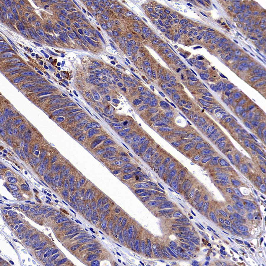 RPS3 Recombinant Rabbit mAb (S-4121-27)