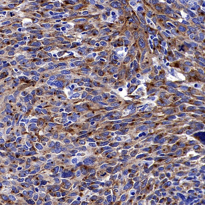 PMEL/Melanoma gp100 Recombinant Rabbit mAb (SDT-434-70)