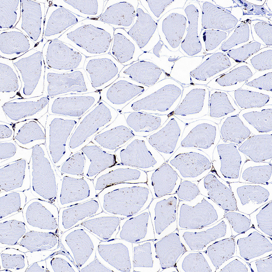 MMP9 Recombinant Rabbit mAb (S-3915-36)