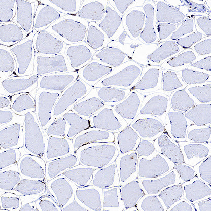MMP9 Recombinant Rabbit mAb (S-3915-36)