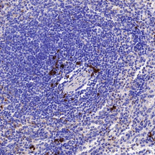 Human IgG1 F(c) Recombinant Rabbit mAb (S-447-20)