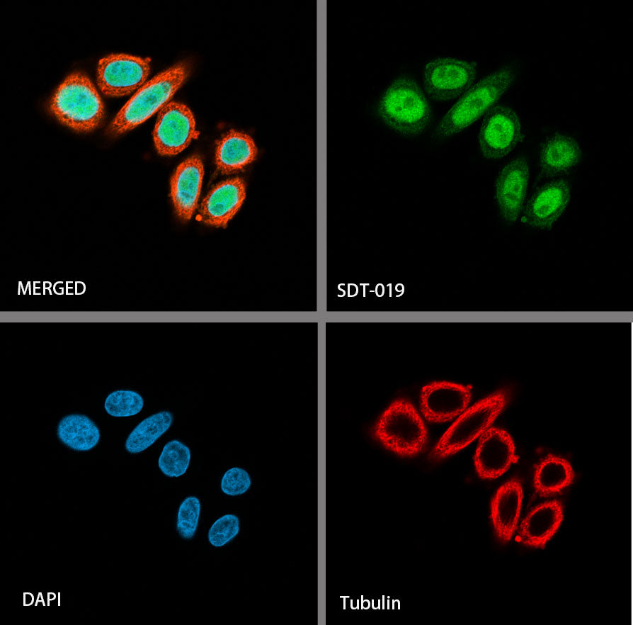 SOX9 Recombinant Rabbit mAb (SDT-019-29)