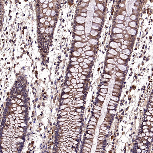 CALHM2 Recombinant Rabbit mAb (S-2671-146)