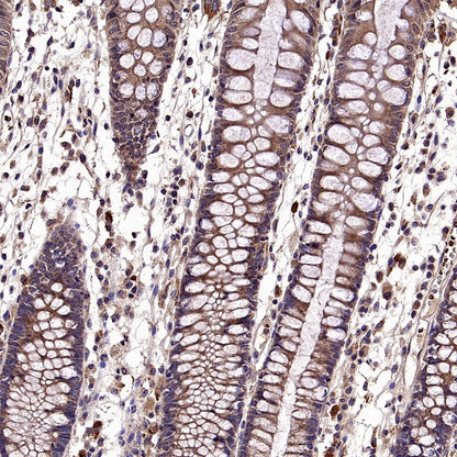 CALHM2 Recombinant Rabbit mAb (S-2671-146)