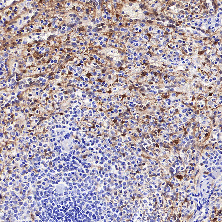 NNMT Recombinant Rabbit mAb (S-3470-58)