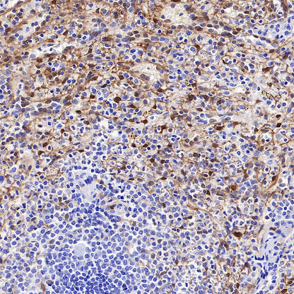 NNMT Recombinant Rabbit mAb (S-3470-58)