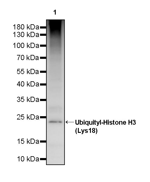 Ubiquityl-Histone H3 (Lys18) Recombinant Rabbit mAb (S-4790)