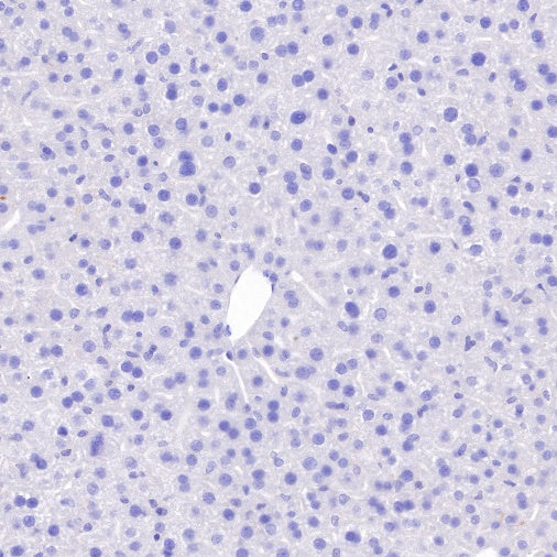 S-RMab® Pan Trk Recombinant Rabbit mAb (SDT-512-5)