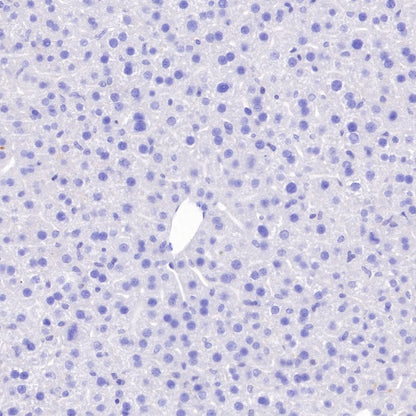 S-RMab® Pan Trk Recombinant Rabbit mAb (SDT-512-5)