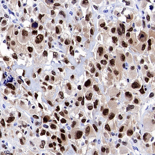 Runx2 Recombinant Rabbit mAb (S-1767-173)