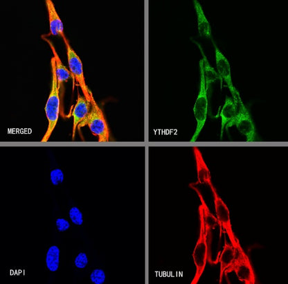 YTHDF2 Recombinant Rabbit mAb (S-1569-42)