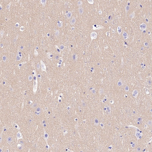 INPP4B Recombinant Rabbit mAb (S-3210-62)