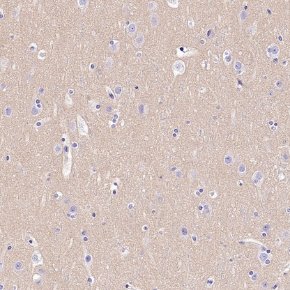 INPP4B Recombinant Rabbit mAb (S-3210-62)
