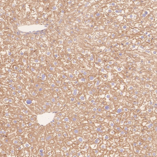 ERAP1 Recombinant Rabbit mAb (S-2509-38)