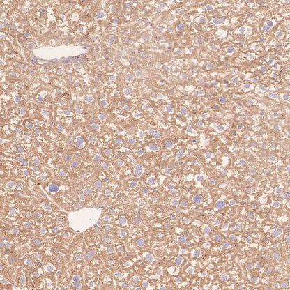 ERAP1 Recombinant Rabbit mAb (S-2509-38)