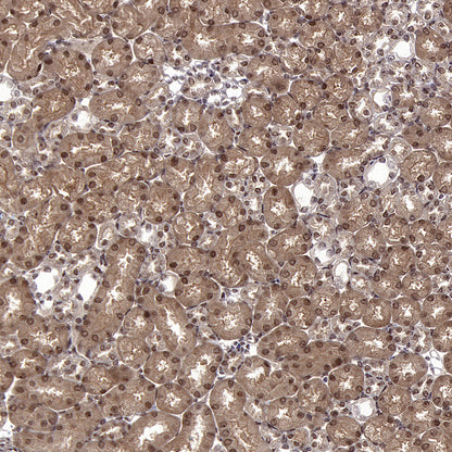 CNBP Recombinant Rabbit mAb (S-4288-3)