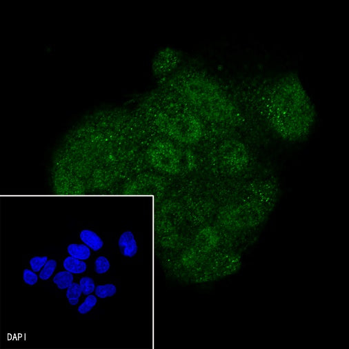 SMAD4 Recombinant Rabbit mAb (SDT-168-62)