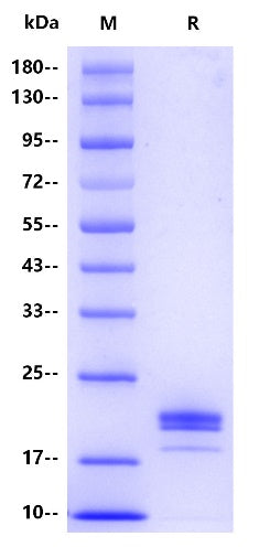 IL-1 beta/IL-1F2 His Tag Protein, Human