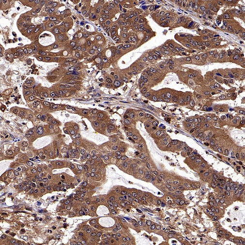 NF-κB p105/p50 Recombinant Rabbit mAb (S-3354)