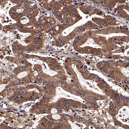 NF-κB p105/p50 Recombinant Rabbit mAb (S-3354)