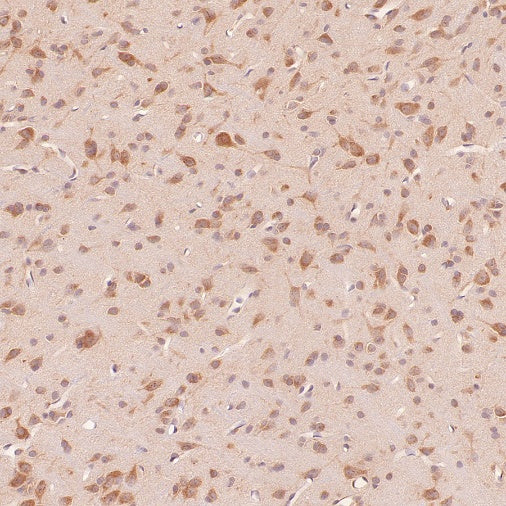 RB1CC1 Recombinant Rabbit mAb (S-2367-251)