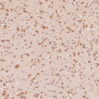 RB1CC1 Recombinant Rabbit mAb (S-2367-251)