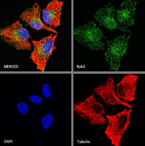 Rab5 Recombinant Rabbit mAb (S-1677-74)