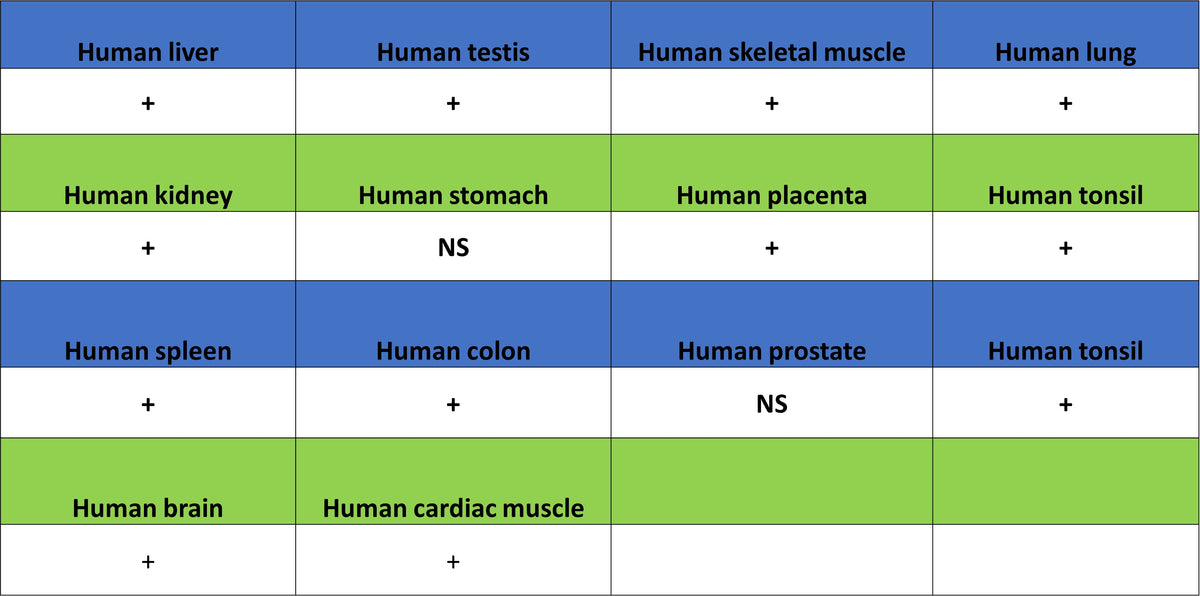 p58IPK/DNAJC3 Recombinant Rabbit mAb (S-4816-205)