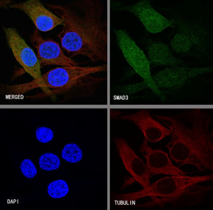 SMAD3 Recombinant Rabbit mAb (S-517-122)