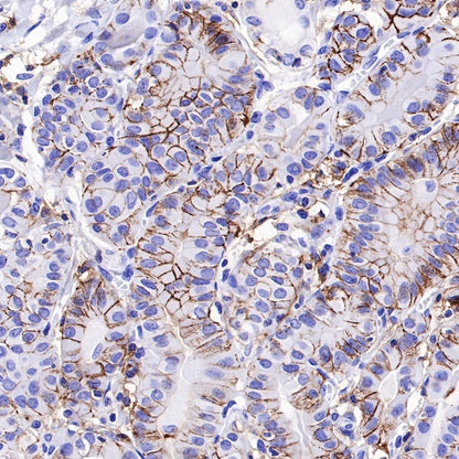 CD44 Recombinant Rabbit mAb (SDT-R107)