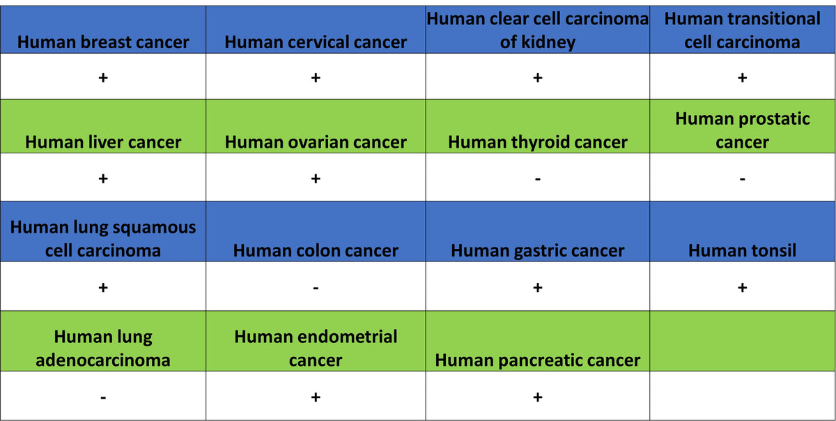 Cyclin E1 Recombinant Rabbit mAb (SDT-4375-44)
