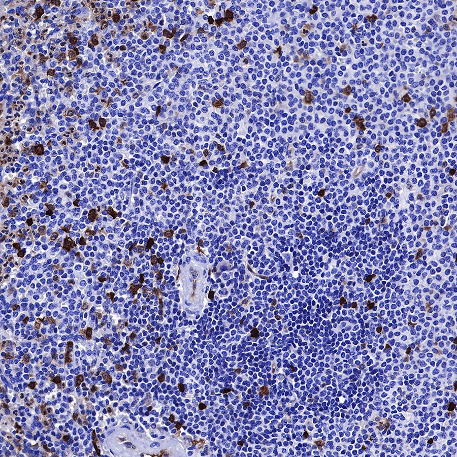 Stathmin 1 Recombinant Rabbit mAb (SDT-383-4)