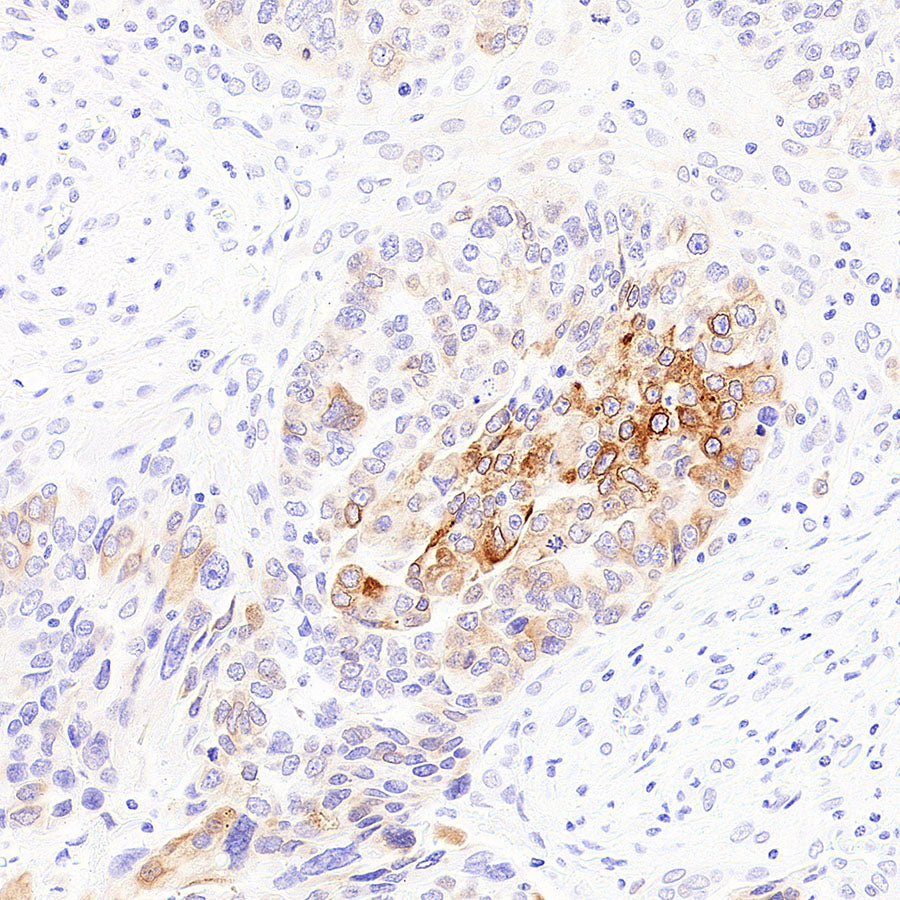 SCD Recombinant Rabbit mAb (S-4467-1)