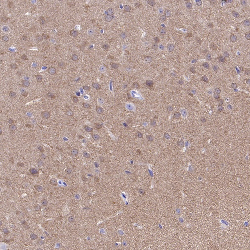 CaMKII alpha Recombinant Rabbit mAb (S-2451-54)