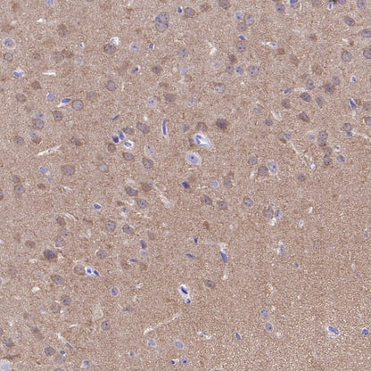 CaMKII alpha Recombinant Rabbit mAb (S-2451-54)