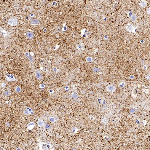 SLC6A1 Recombinant Rabbit mAb (SDT-2424-278)