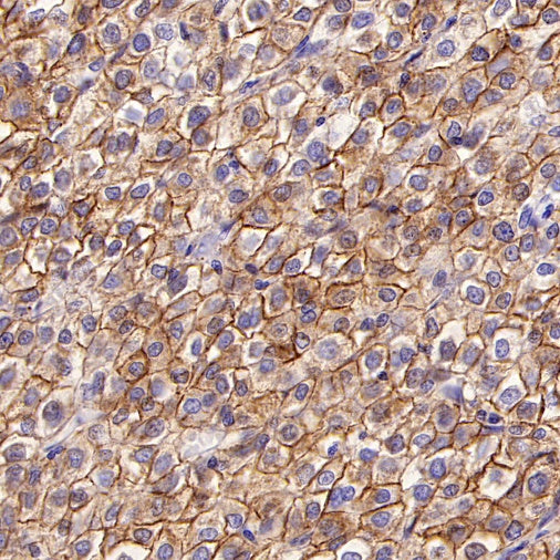 LPA Rabbit Polyclonal Antibody