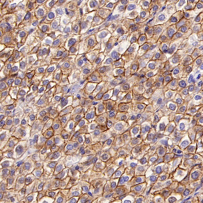 LPA Rabbit Polyclonal Antibody