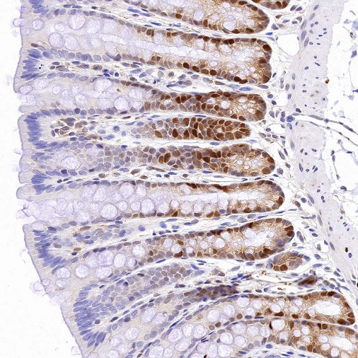 CDK2 Recombinant Rabbit mAb (S-1308-13)