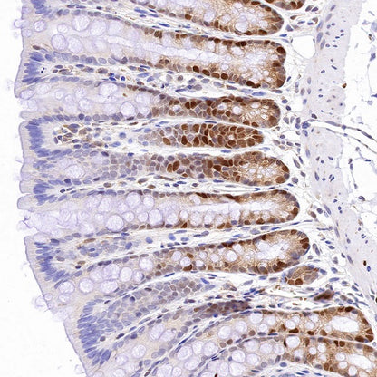 CDK2 Recombinant Rabbit mAb (S-1308-13)